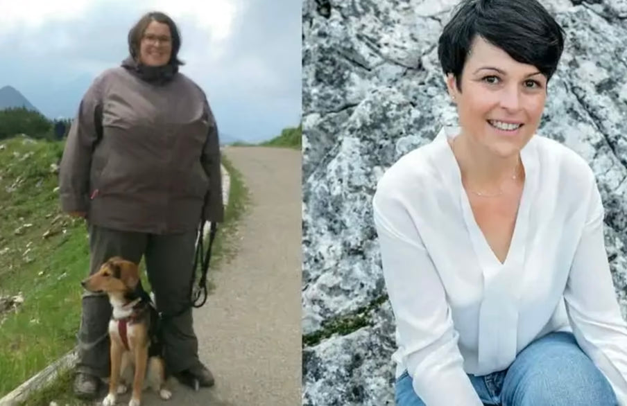 Sandra W. vorher und nachher
